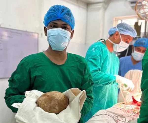 श्रीलंकामा बिरामीको मूत्रथैलीबाट ३ किलो भन्दा बढिको ढुंगा निकालियो